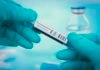 2nd Wave of Coronavirus (Covid-19) Will Have Severe Impact Than Earlier Warn by WHO